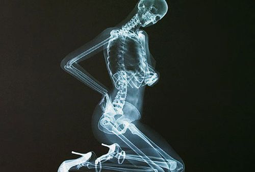 何为骨感美 --------这就是