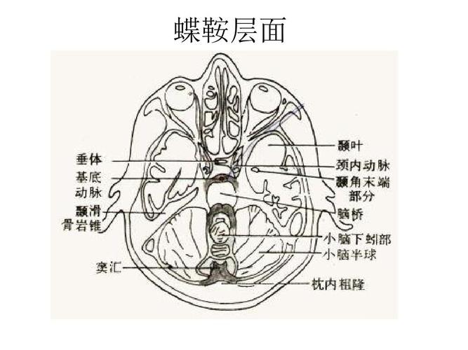 蝶鞍层面