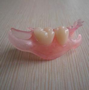 牙齿缺失常见的修复方法有活动义齿(活动假牙)修复,固定搭桥修复