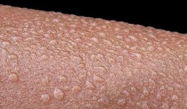 这种蜘蛛咬伤后,你就危险了,网友:等于服用了催情药