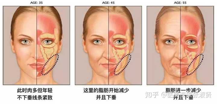 求问大家,嘴角两边有鼓鼓的又像木偶纹的东西是什么呢