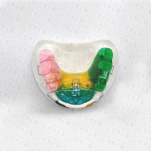 专业定制唇挡丝矫治器 螺旋簧v字型前扩弓器矫正牙齿专用