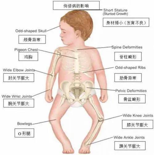 眼部症状:眼睛干燥症,夜盲症,角膜软化;维生素a缺乏以后会出现:维生素