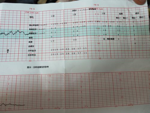 2019-09-04 16:56                              胎心监护是通过监测