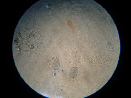 看图识病-疥疮 - 皮肤及性传播疾病讨论版 - 爱爱医