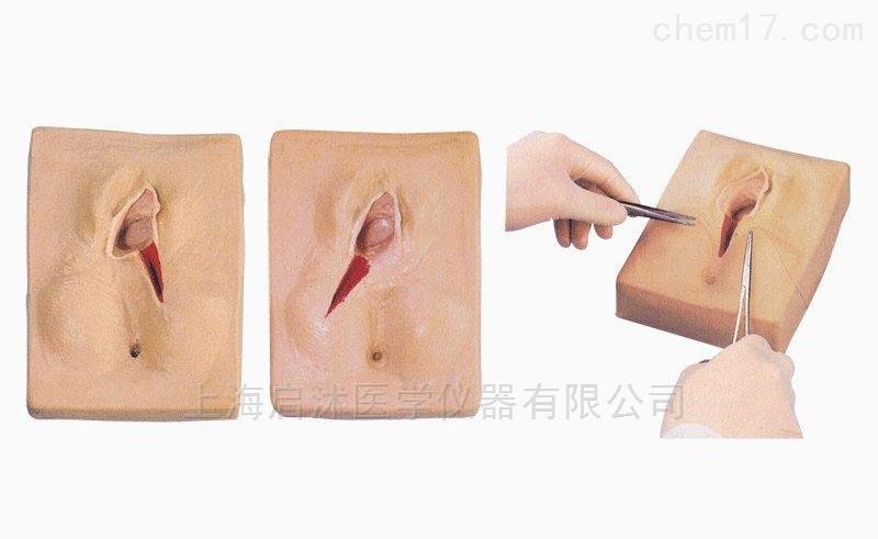 会阴侧剪模型侧切训练模型