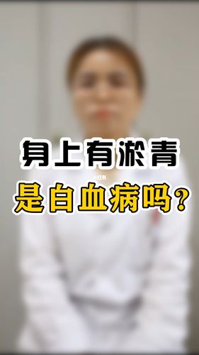 身上有淤青就是白血病吗?_健康养生_知识_科学科普