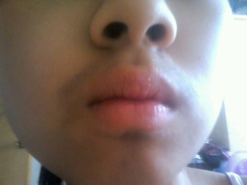 嘴上的汗毛为什么这么黑