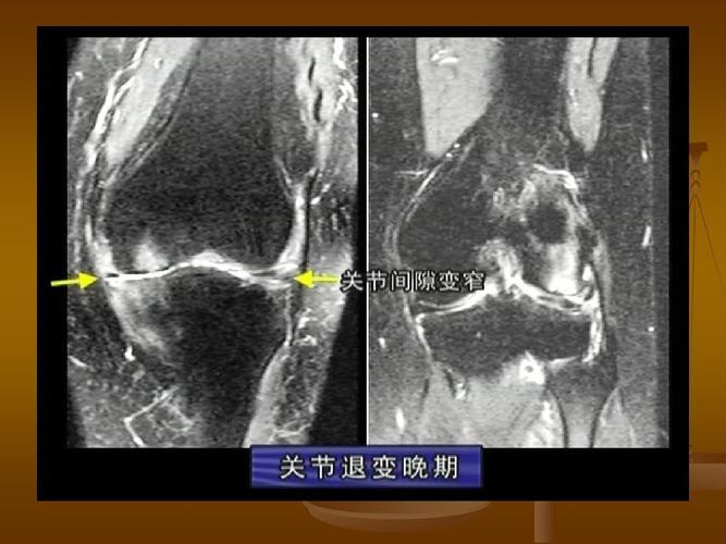 骨关节3ppt  第6页 (共26页,当前第6页) 你可能喜欢 最全人体解剖图
