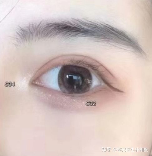 哪种双眼皮最好看双眼皮有几种