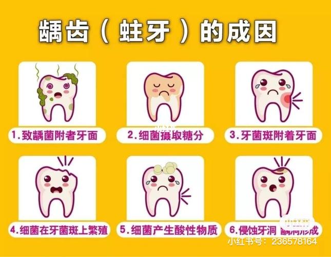 龋齿(蛀牙)形成的原因