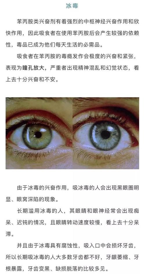 往往是给他人的第一印象 而吸毒者的眼睛  也会有一些不一样的特征