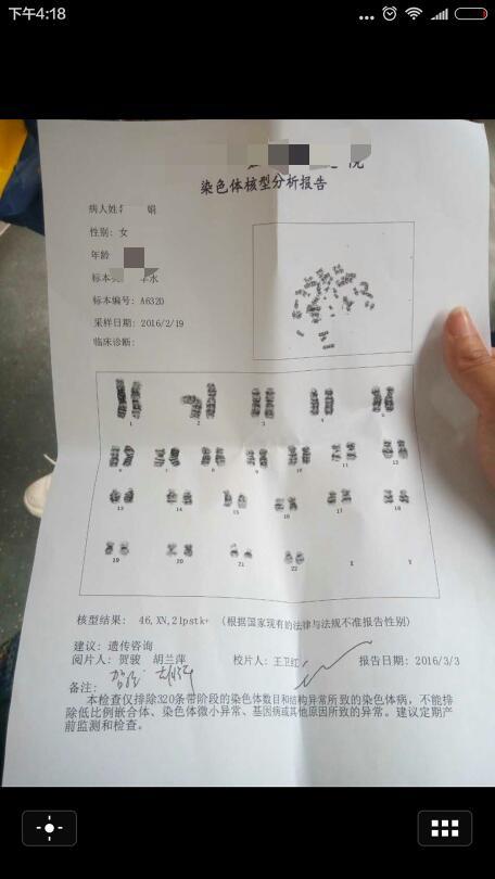 羊水穿刺检查
