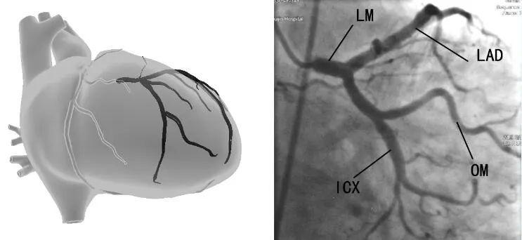 冠脉造影的常用体位,你都掌握了吗?