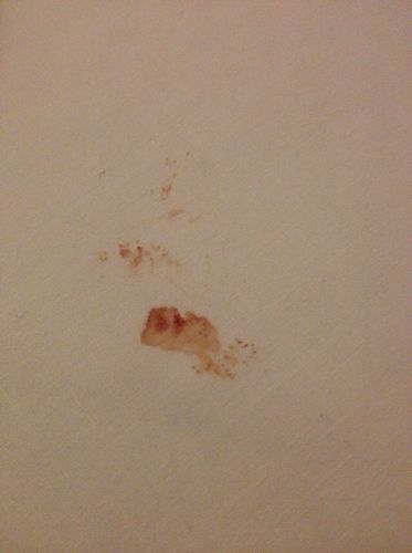 我女朋友第一次流了很多血,怎么办?会不会出事?