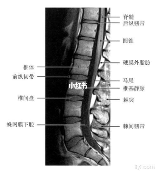 腰5骶1突出和腰4,5节突出_马尾_倒立_帆船_马尾神经损伤_医疗健康