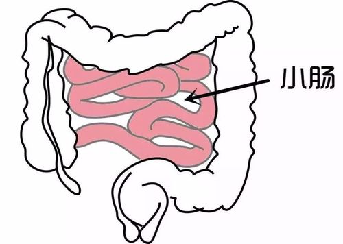 可能是急性肠梗阻