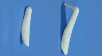 膨体隆鼻要比硅胶隆鼻更容易感染吗?