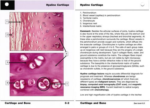 netter"s histology flash card—6《cartilage and bone》