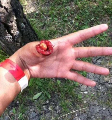 4,好好的一个手指就这么断了,怎么不见流血呢?