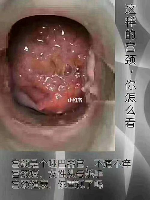 宫颈_妇科_疼痛感_保养_女性妇科_医疗健康_医疗健康