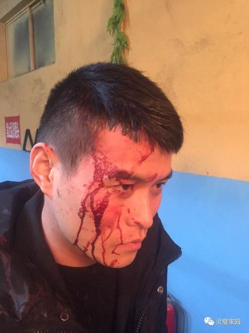 这是案发时,他被打伤的图片