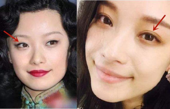 【避坑指南】论双眼皮的重要性,看这几位女明星就知道了!