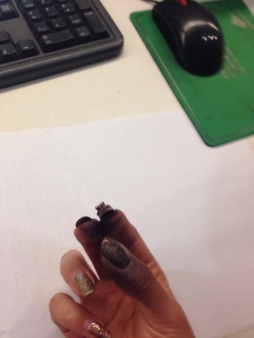 手被插座连电砰的一声电火花炸了一下,熏黑了,洗手了之后黑色都洗掉了