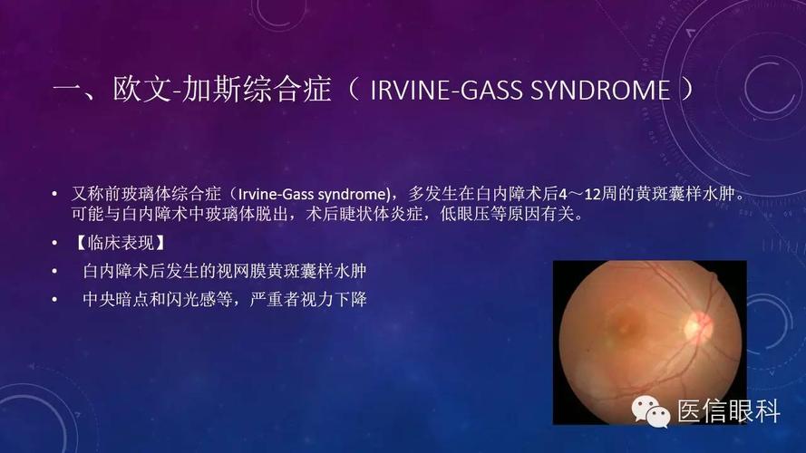 眼科常见综合征