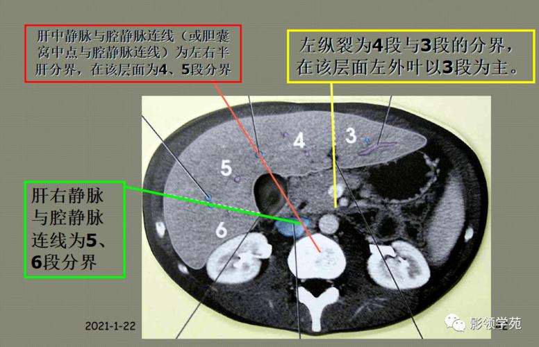 肝脏的表面解剖及分叶分段