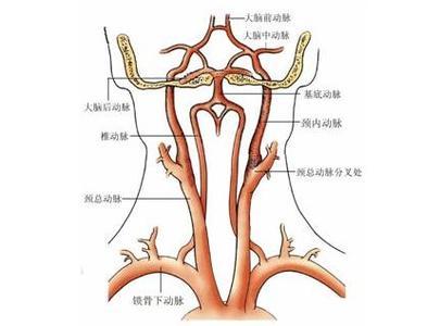 颈动脉狭窄主要临床表现