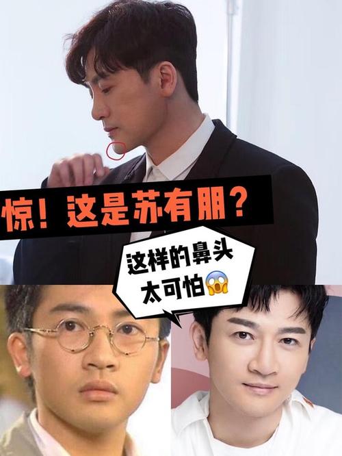 苏有朋的鼻子怎么变成了这样9898苏有朋,年少
