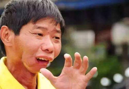 这种果实很多人喜欢吃,毒性和砒霜一样,不仅会烂嘴,还