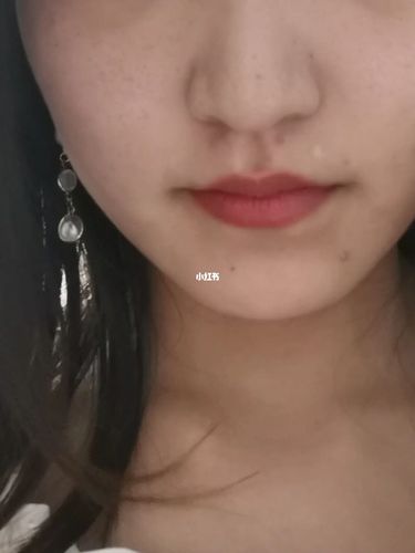 好想嘴凸,但这是不是嘴巴凹陷?姐妹们_嘴凸_美妆_医美