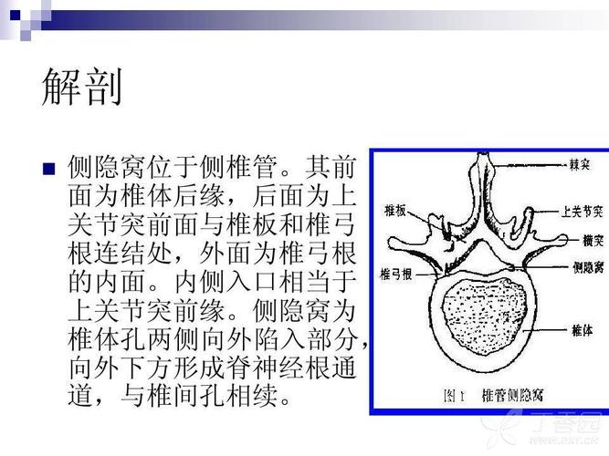 腰椎椎体侧隐窝解剖及狭窄常见原因