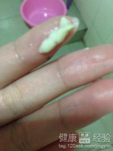 白带异常有哪些表现