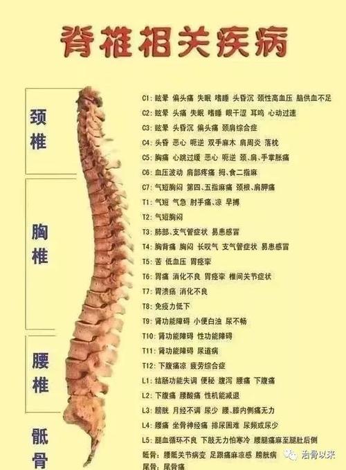 腰椎间盘突出伴椎管狭窄压迫神经痛怎么治疗好分享腰椎间盘突出断根