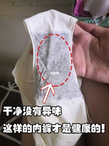 内裤总是湿湿的,白带有异味要怎么办?_凝胶_妇科炎症