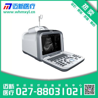 中旗zq-6600全数字超声诊断系统/手提式b超/便携b超