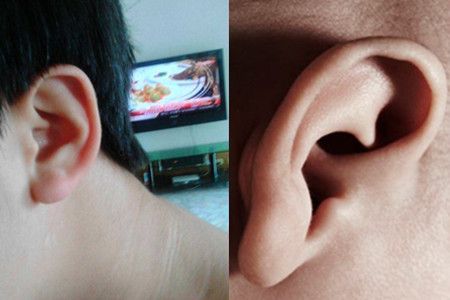 【图】耳垂斜线皱纹 自测健康小知识带你看