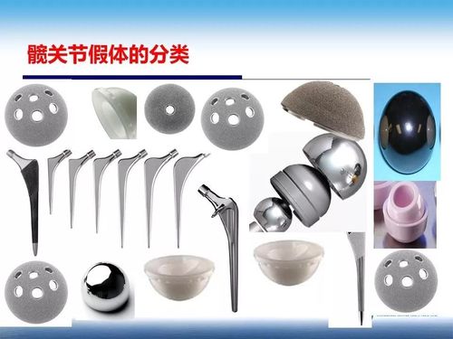 人工髋关节置换的假体选择