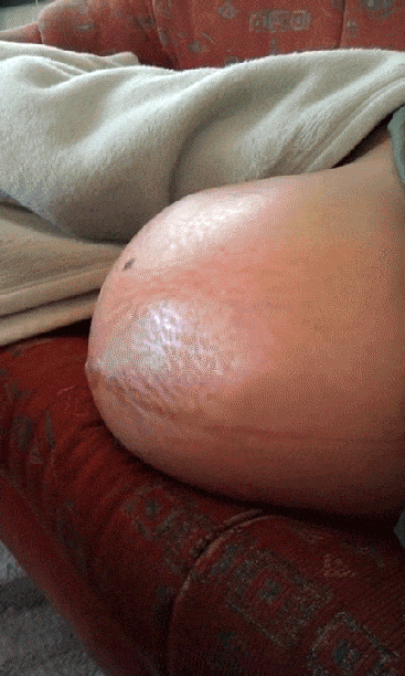 5张实拍宝宝胎动图,简直担心孕妈肚里可能是个混世魔王
