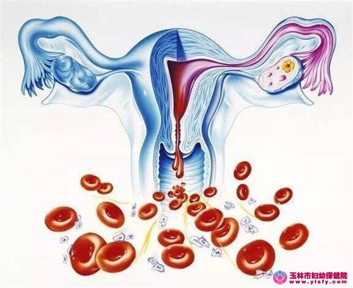 健康宣教|异常子宫出血小常识