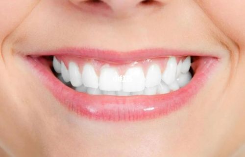 这几件事情,做完肯定白_洁牙_美牙_美白_牙结石_口腔_海涛口腔攻略_美