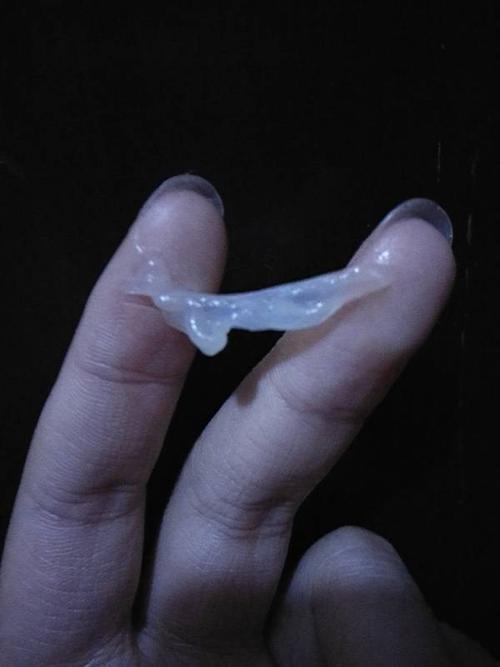 白带这个样子怎么回事啊,橡果冻一样,没有味道