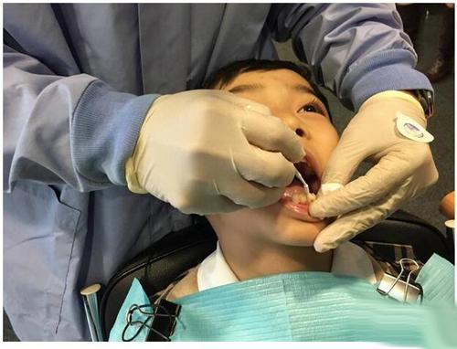 孩子得了蛀牙怎么办 蛀牙牙痛的治疗方