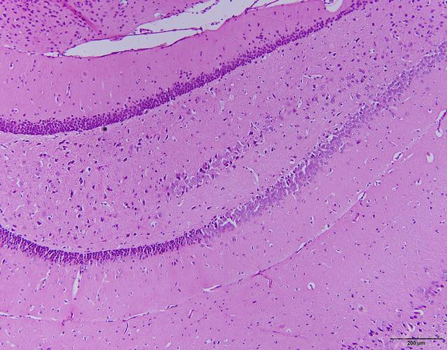 慢性脑缺血小鼠脑组织石蜡切片he染色读片求助