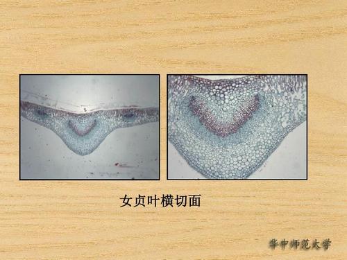 女贞叶横切面