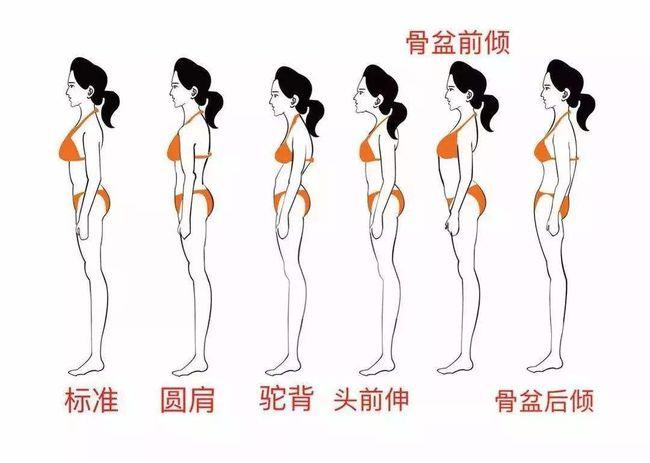 体态不良往往是多个问题结合,例如:圆肩 驼背 探颈 骨盆前倾.