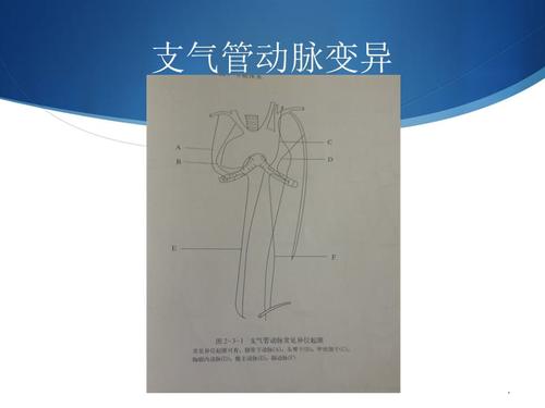支气管动脉的解剖及病变ppt课件